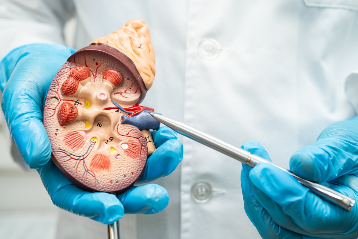 Kidney disease, Chronic kidney disease ckd, Doctor hold human model to treat and study in hospital.
