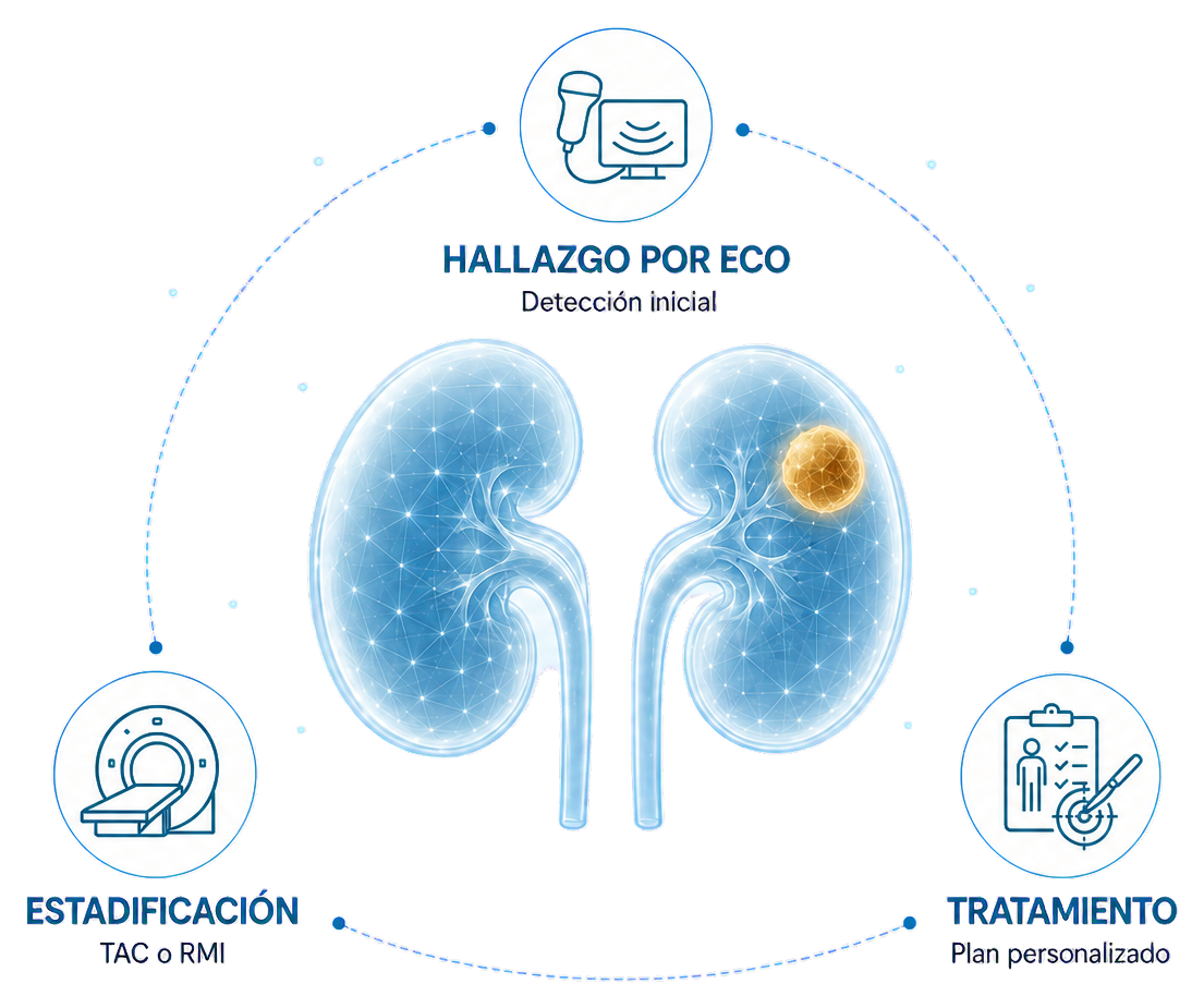 Esquema de evaluación diagnóstica del tumor renal: ecografía, tomografía y resonancia