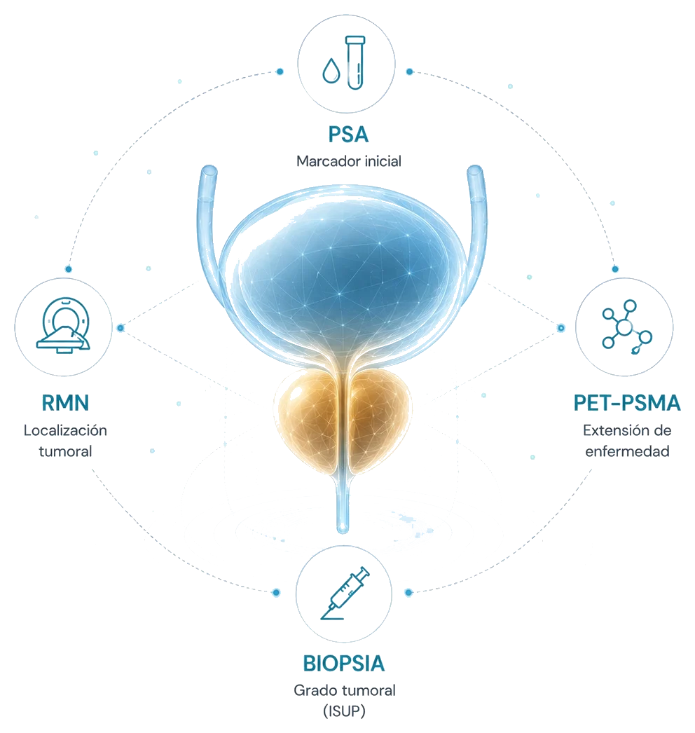 Esquema de evaluación diagnóstica: PSA, RMN, biopsia y PET-PSMA